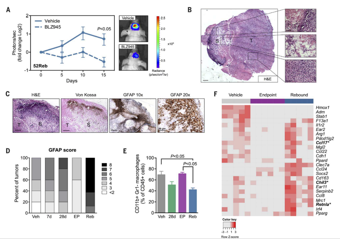 Science |腫瘤微環境是神經膠質母細胞瘤獲得CSF-1受體阻斷劑抵抗的基礎